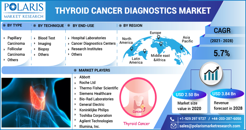  Thyroid Cancer Diagnostics Market Report 2023